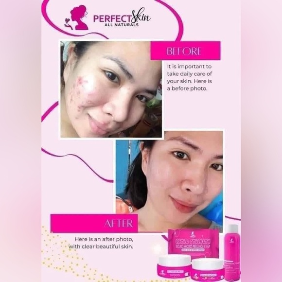 💓Perfect Skin Rejuv set💓 - Picture 2 of 8